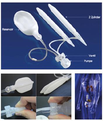 ����������ֲ����