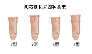 �º�ʽ΢�������ӳ���